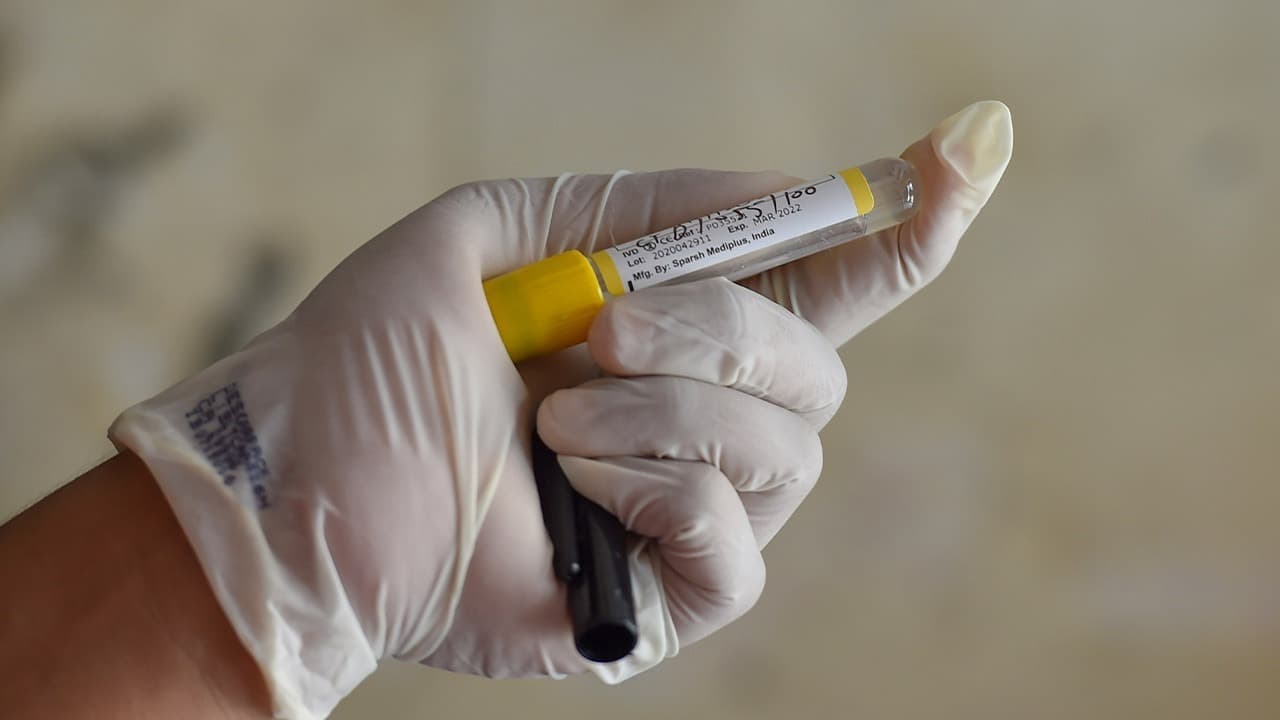 जादवपुर के CPIM कैंडिडेट सुजन चक्रवर्ती कोरोना संक्रमित, बंगाल में लगातार बढ़ रहे कोविड-19 के केस