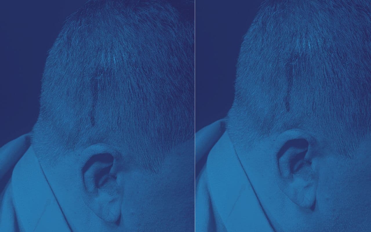 बासुकिनाथ : तालझारी प्रखंड के खिजुरिया गांव में जमीन विवाद सुझलाने गयी पुलिस पर पथराव, 7 घायल