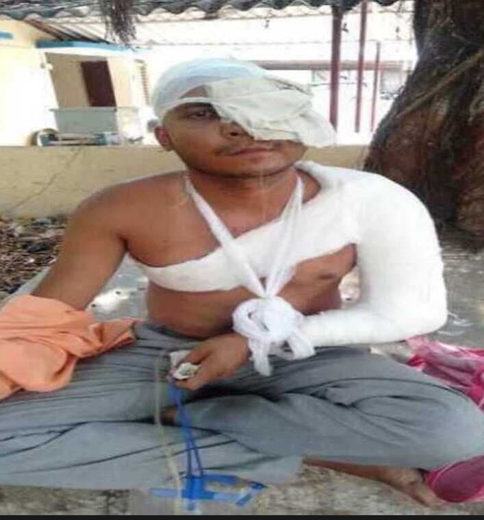 Gorakhpur News: ससुर ने ही छीन ली दामाद के आंख की रोशनी, युवक और उसके पिता पर किया जानलेवा हमला Gorakhpur News: ससुर ने ही छीन ली दामाद के आंख की रोशनी, युवक और उसके पिता पर किया जानलेवा हमला