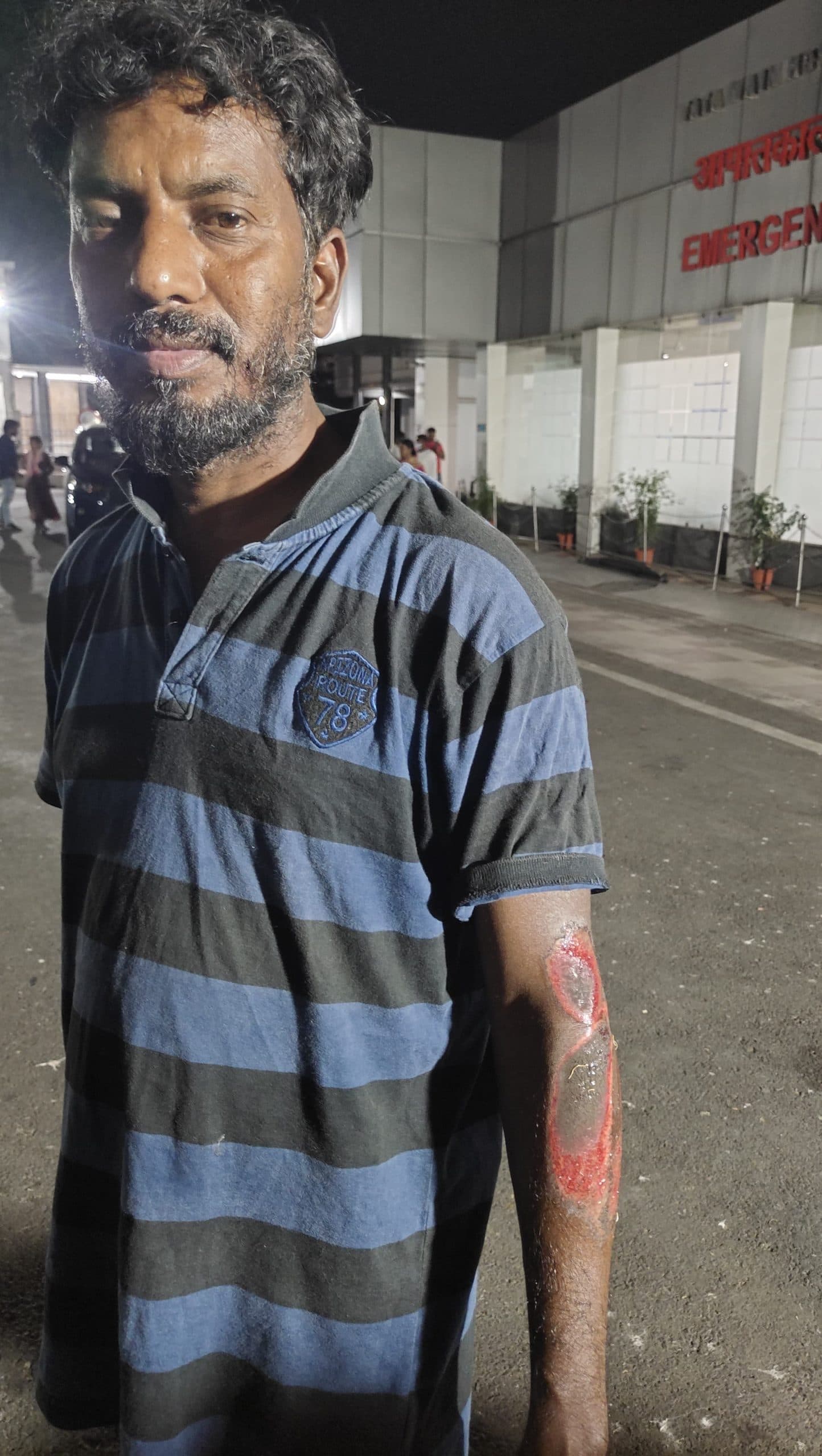 एमजीएम : नाटक प्रस्तुत करने जा रहे कलाकारों की गाड़ी पलटी,आठ जख्मी