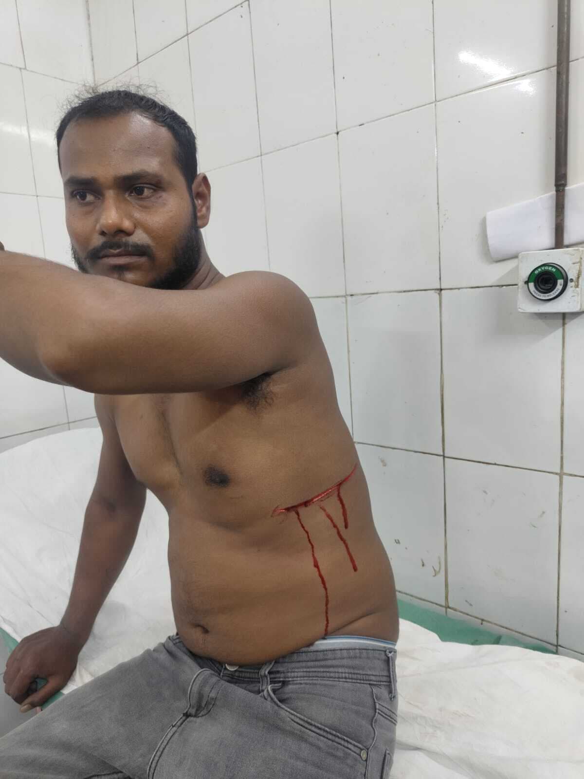 भुइयांडीह में टोटो चालक पर उस्तुरा से हमला