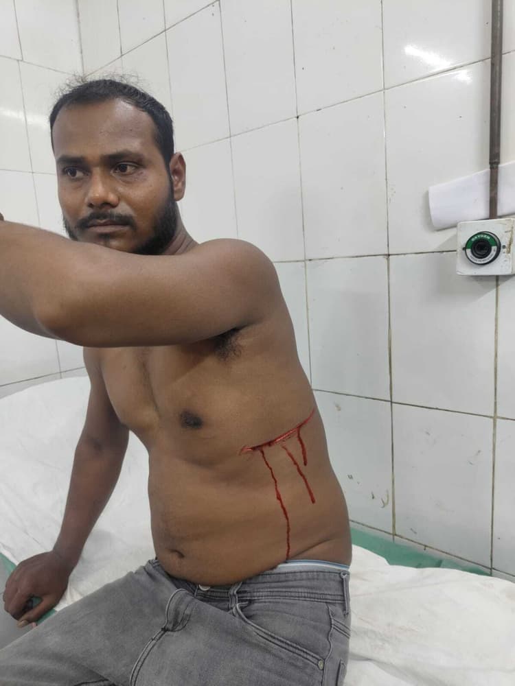 भुइयांडीह में टोटो चालक पर उस्तुरा से हमला