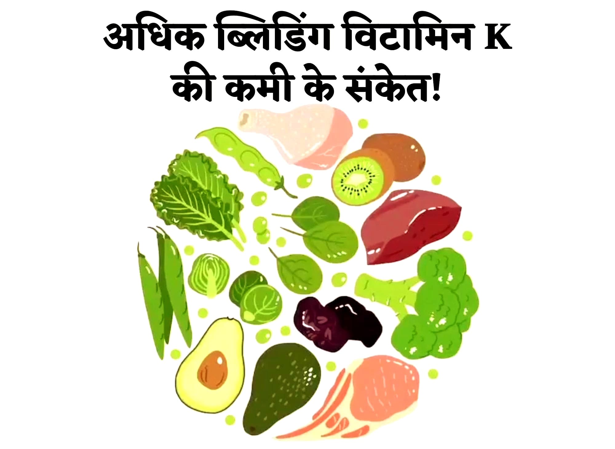 Vitamin K: 'विटामिन के' की कमी से हो सकते हैं कई रोग, अधिक ब्लीडिंग हो सकती है 'विटामिन K' की कमी के संकेत