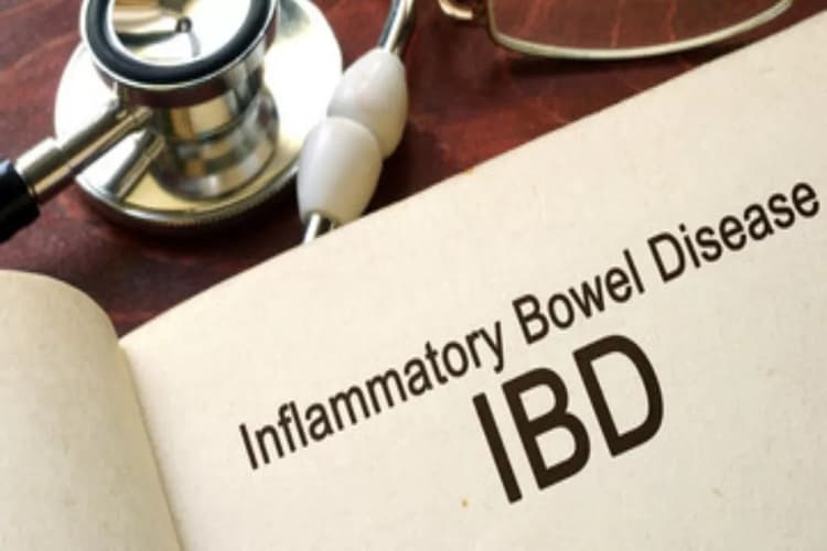 World IBD Day 2024: विश्व इंफ्लेमेटरी बाउल डिजीज आज, जानिए इतिहास, महत्व और थीम