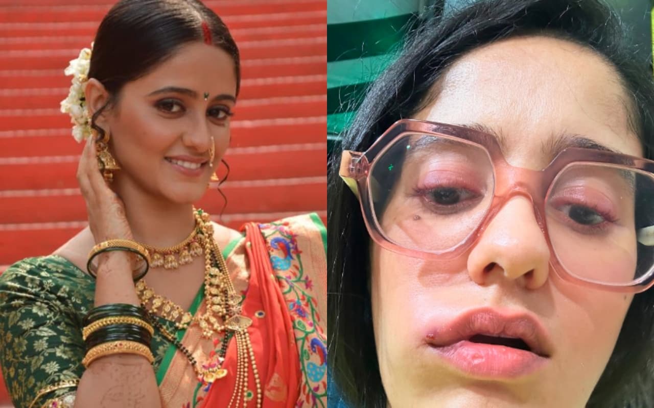 Ghum Hai Kisikey Pyaar Meiin की ‘सई’ आयशा सिंह के चेहरे का हुआ बुरा हाल, तसवीर शेयर कर बोलीं- प्रार्थना करें