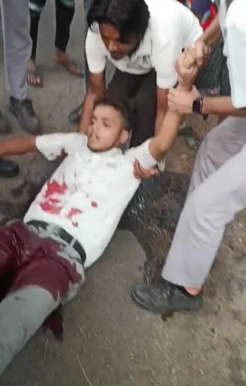 बर्मामाइंस : सांड के हमले से एनटीटीएफ के छात्र जख्मी