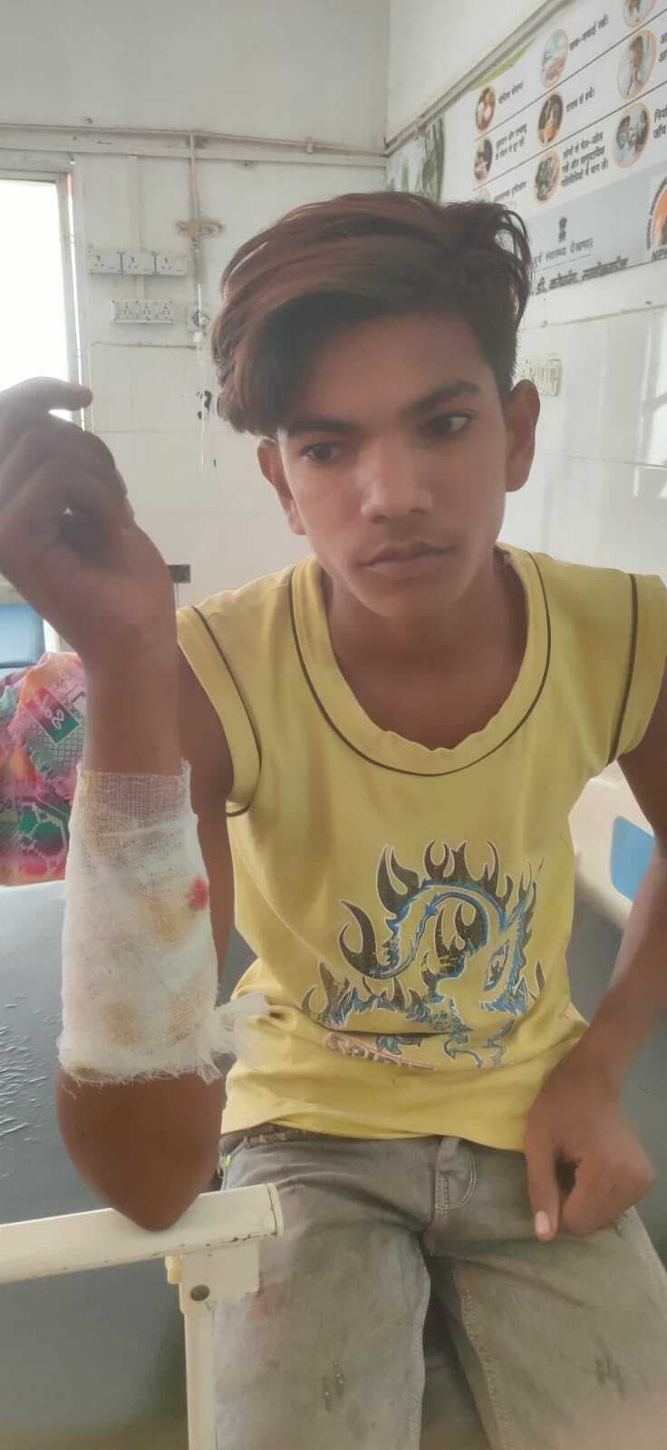 दातुन तोड़ने गये युवक पर जंगली सुअर ने किया हमला, घायल