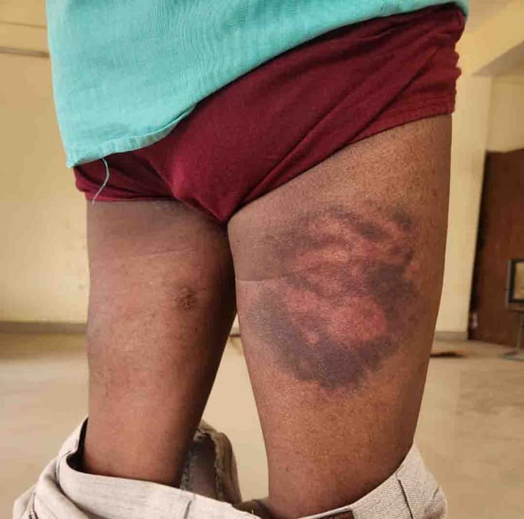 कांग्रेस नेता का आरोप, हाजत में निर्वस्त्र कर उन्हें पीटा गया