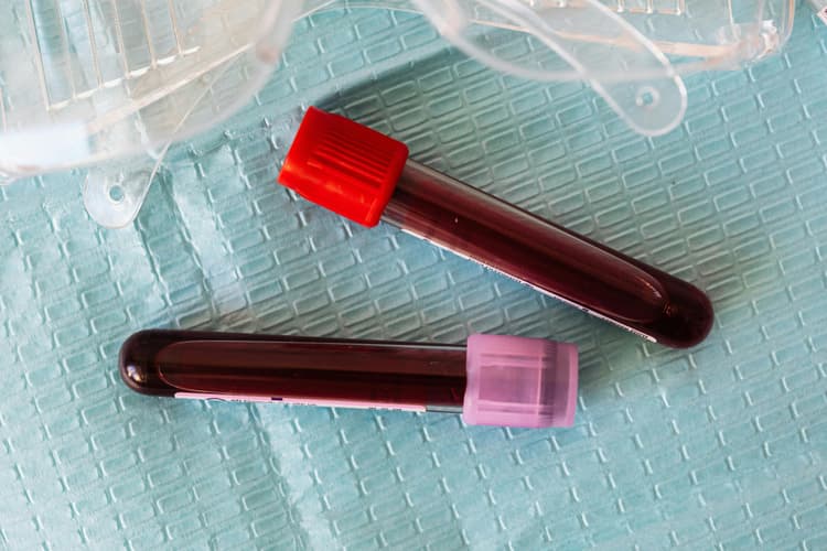 आखिर क्यों होता है खून का रंग लाल, कारण जान चकरा जाएगा दिमाग