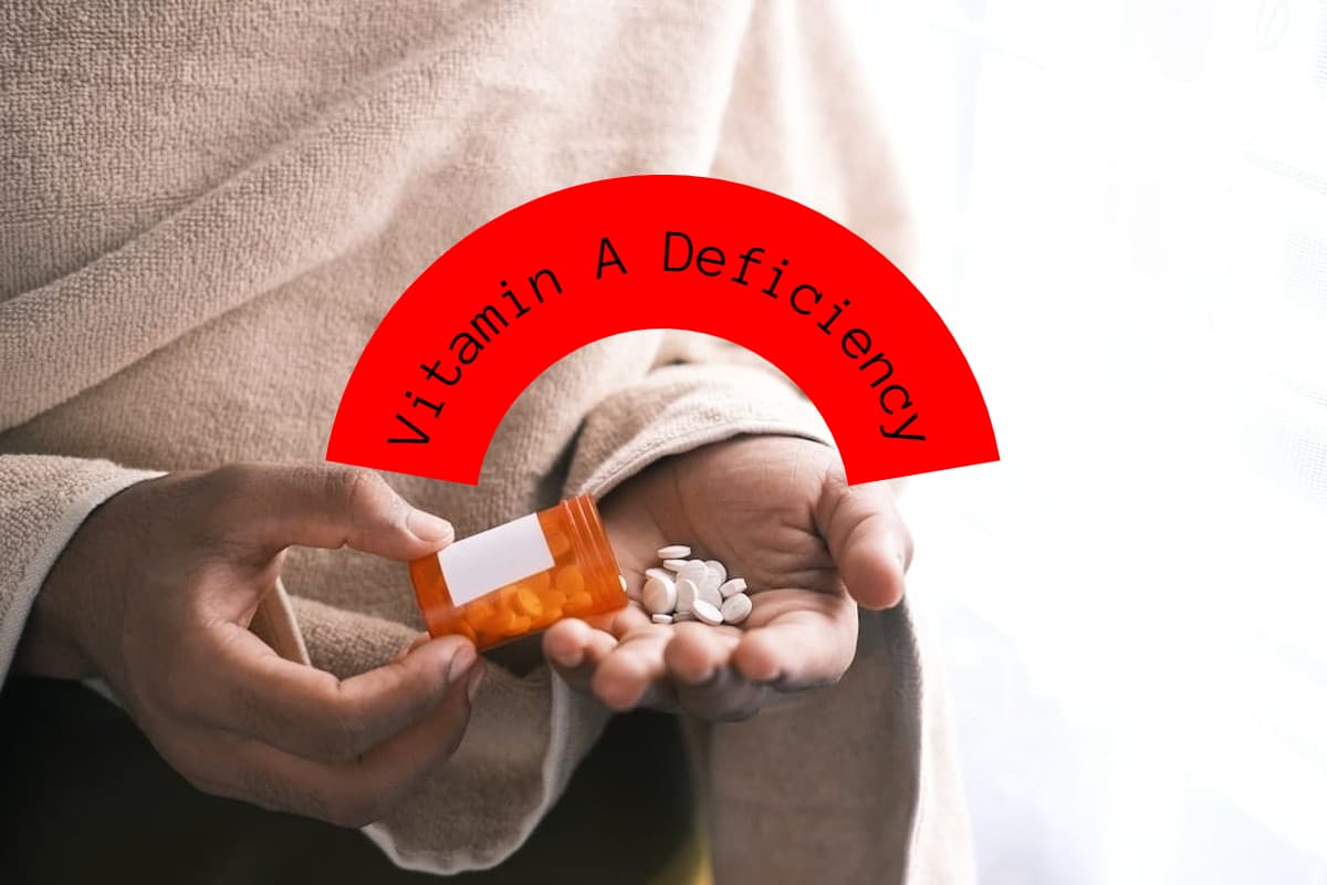 Vitamin A Deficiency: शरीर में विटामिन-ए की कमी पूरा करने वाले 5 फूड्स