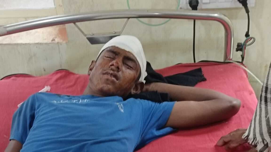 वर्चस्व को लेकर फायरिंग, नाबालिग चांद के सिर को जख्मी करते निकली गोली