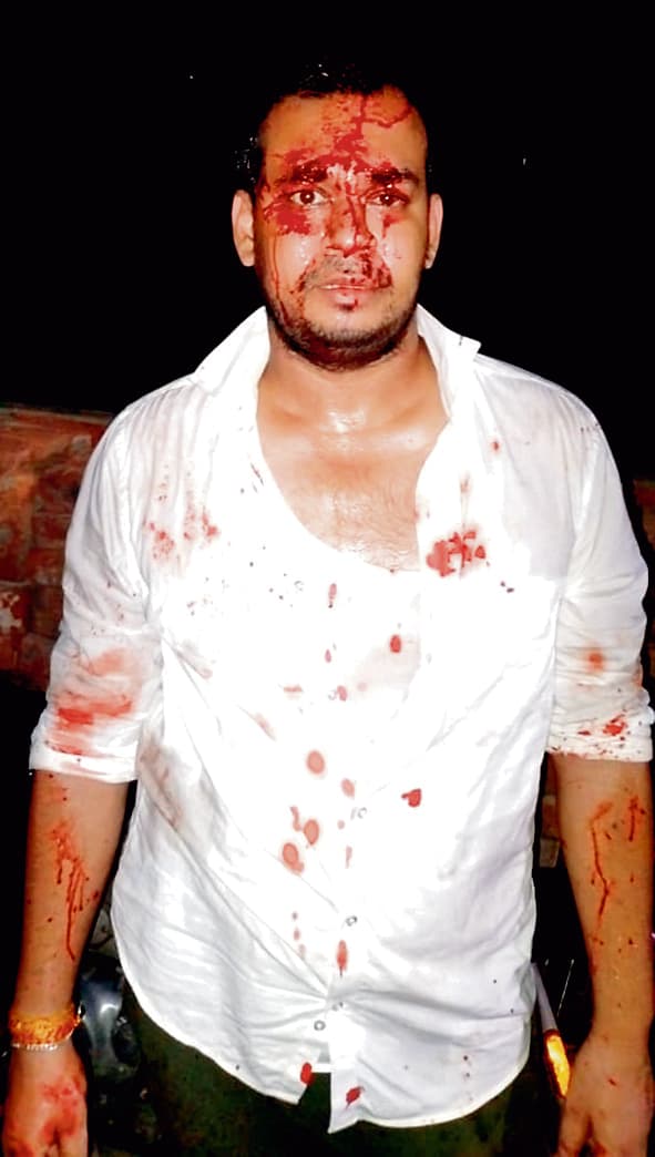 दासनगर में तृणमूल के दो गुट फिर आपस में भिड़े, दो लोग हुए घायल