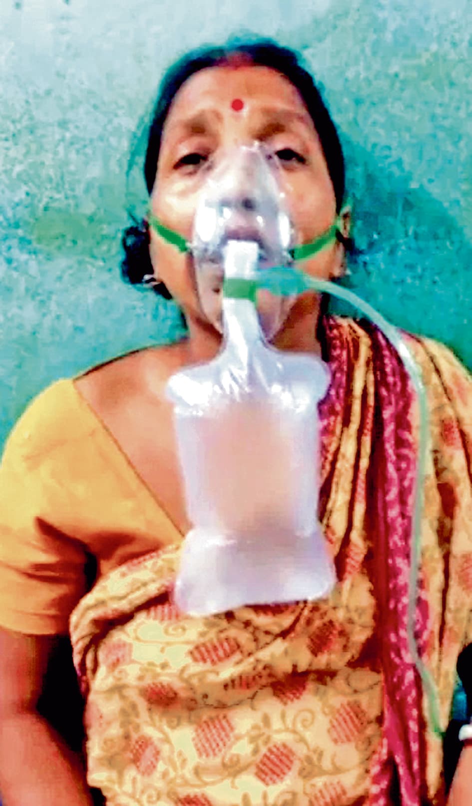 कुलतली : सर्पदंश की शिकार महिला सांप को पकड़कर पहुंची अस्पताल