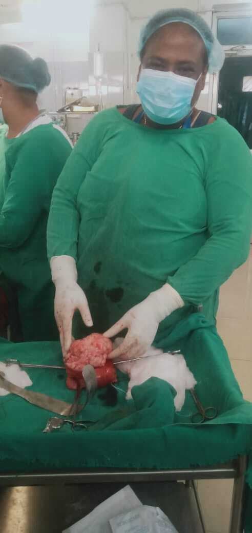 सदर अस्पताल में महिला का ऑपरेशन कर यूट्रस से निकाला ट्यूमर