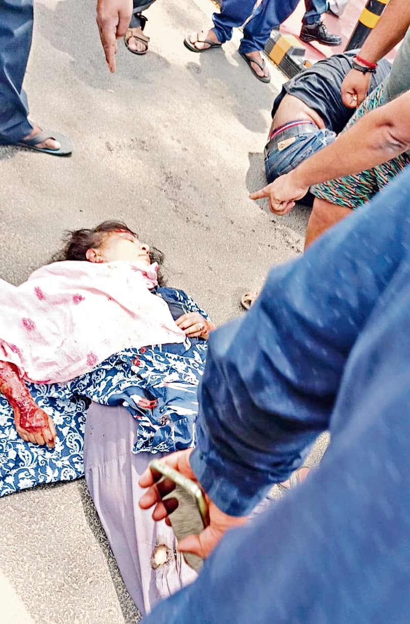 कार के धक्के से युवक का पैर कट कर रोड पर गिरा, महिला गंभीर