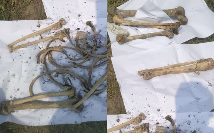 WB News: भांगड़ के खाल में सीआईडी को मिली बांग्लादेश के सांसद अनवारुल आजिम अनार की हड्डियां