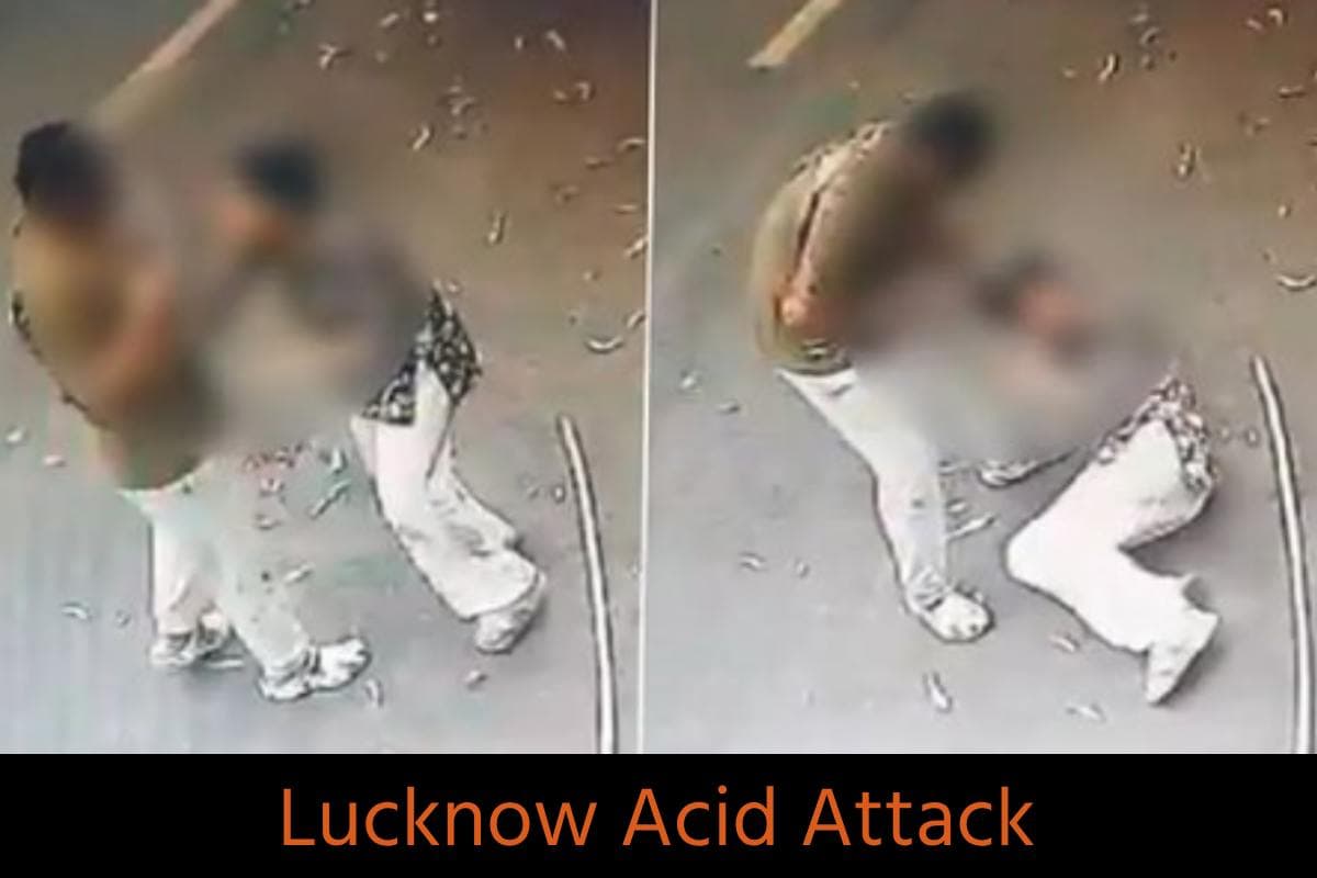 Lucknow Acid Attack: युवती पर एसिड अटैक के बाद भाई बोतल से डालता रहा पानी