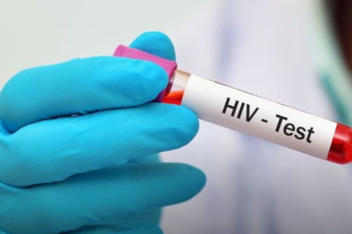 HIV Case: त्रिपुरा में HIV से 47 छात्रों की मौत, 828 पाए गए पॉजिटिव, वजह आई सामने