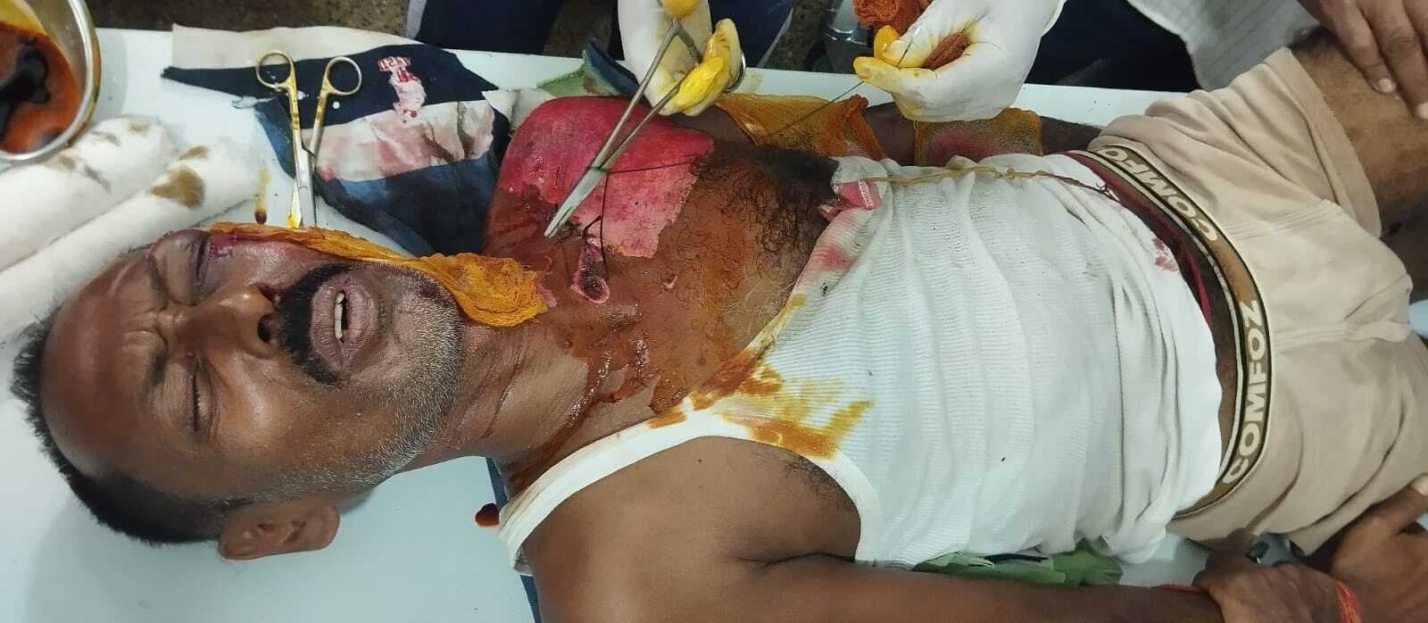 स्काॅर्पियो व ऑटो की टक्कर में दस जख्मी, पांच की हालत गंभीर