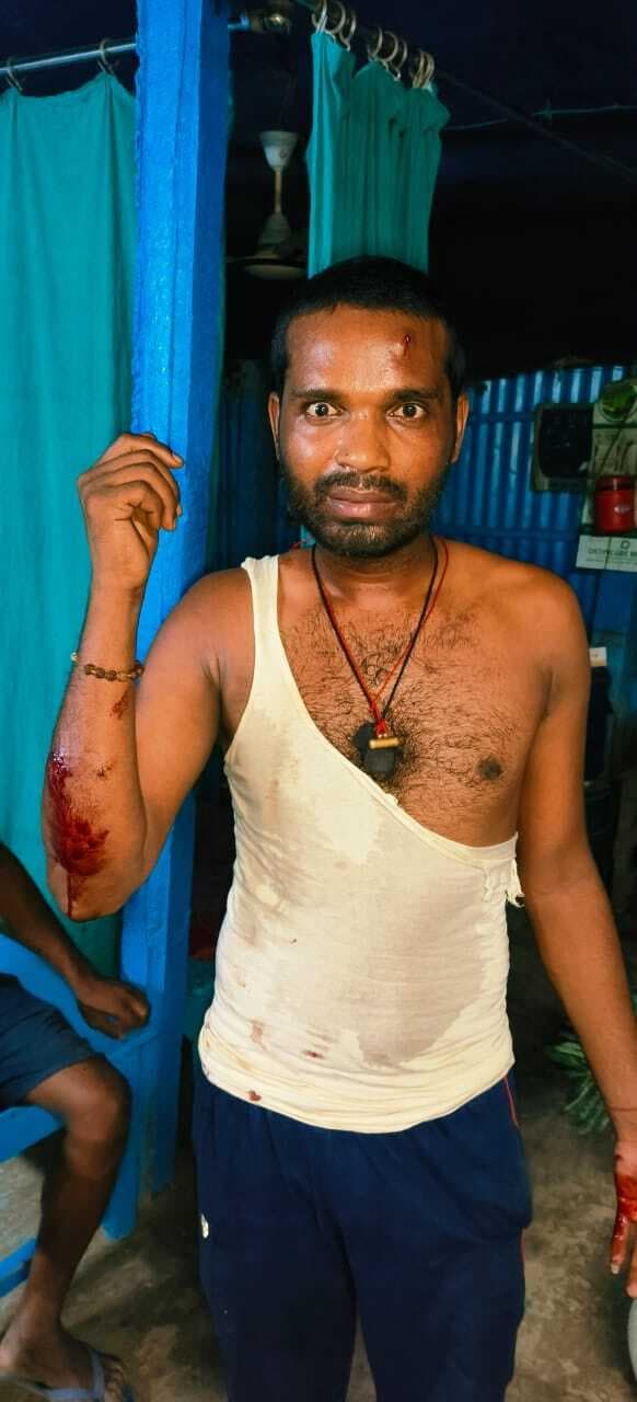 जमीन विवाद में नहीं मानी पंचायत की बात, घर में घुस मारपीट कर किया जानलेवा हमला