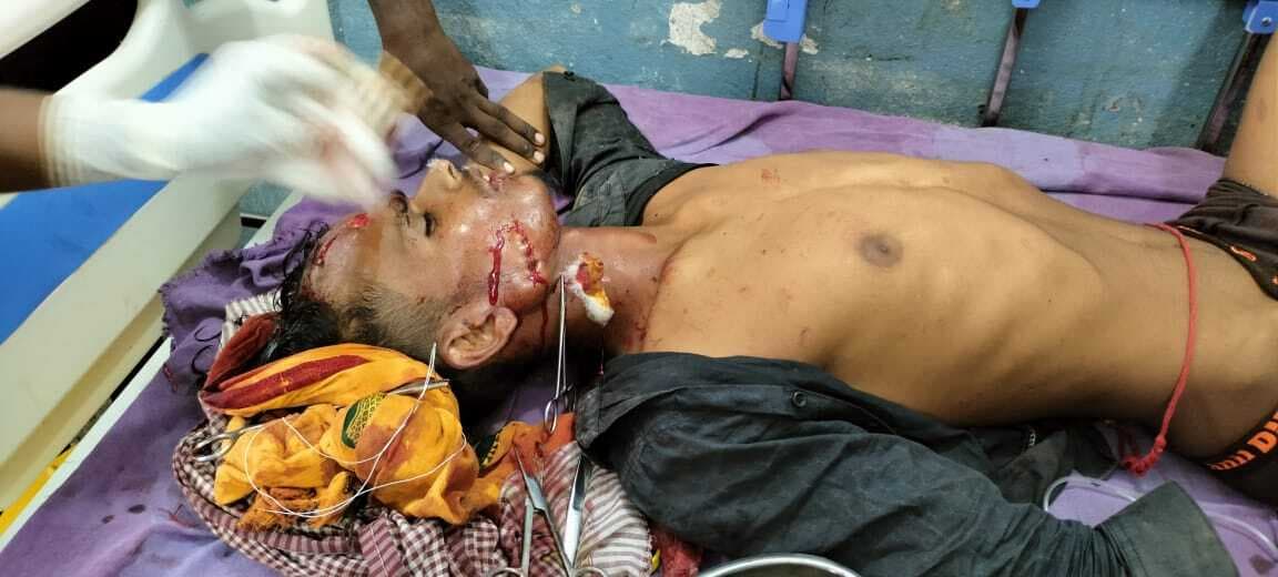 कार और टोटो की टक्कर में टोटो चालक गंभीर रूप से घायल