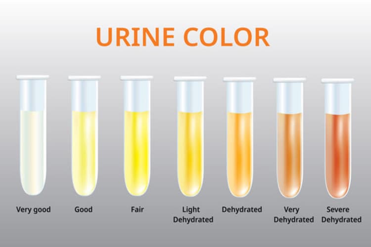 What is your Urine Color? :क्या पेशाब के रंग से पता चलता है शरीर में हाइड्रेशन का लेवल?