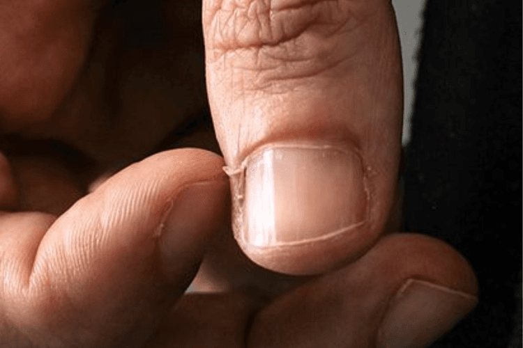 Nail Care Tips: नाखून के बगल की स्किन निकलने से अगर आप भी है परेशान तो अपनायें ये टिप्स