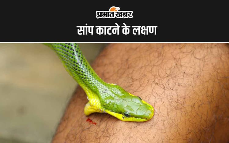 Snakebite: सांप के काटने पर शरीर में दिखने कैसा लक्षण दिखता है? जानिए स्नेक बाइट पर क्या करें