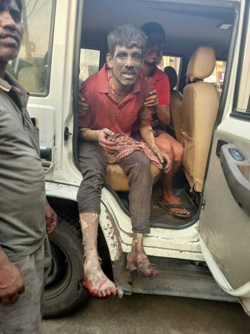 अग्नि प्रभावित खदान में कार्य के दौरान कर्मी गोफ में गिरा, हालत गंभीर