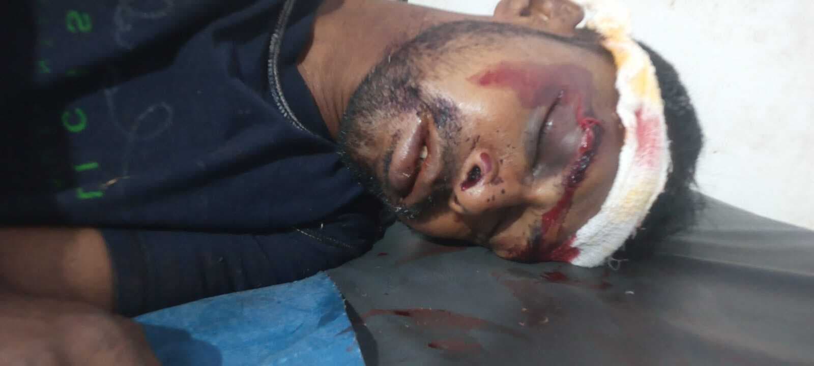 बेहोशी की अवस्था में सड़क किनारे मिला युवक, छानबीन में जुटी पुलिस