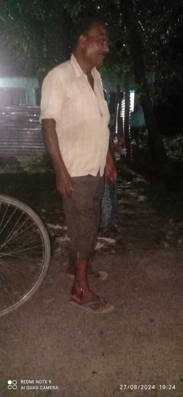 तेंदुआ के हमले में एक व्यक्ति बुरी तरह से जख्मी