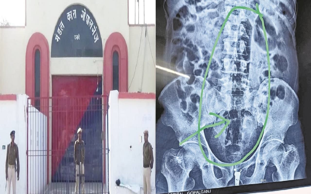 बिहार की जेल में कैदी ने गुप्तांग में डाल लिया पाइप, पेट में फंसी, डॉक्टर भी रह गए दंग, जानिए पूरा मामला… बिहार की जेल में कैदी ने गुप्तांग में डाल लिया पाइप, पेट में फंसी, डॉक्टर भी रह गए दंग, जानिए पूरा मामला…