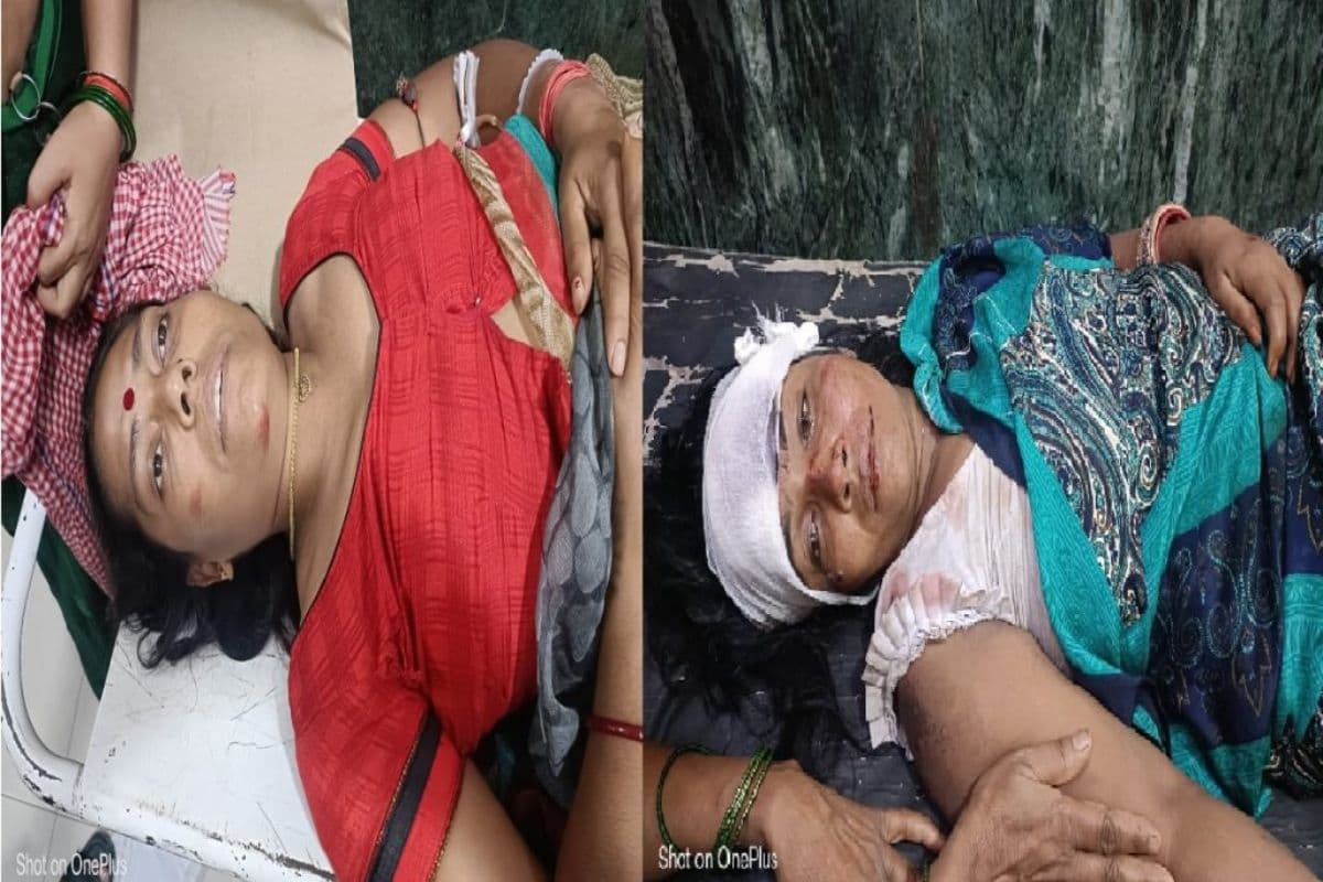Patna news: कंकड़बाग में तेज रफ़्तार की सफारी ने महिला और बच्चों समेत पांच को कुचला, चालक फरार, लोगों ने जमकर किया हंगामा