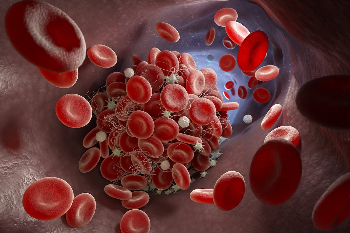 Platelet Count : डेंगू के अलावा शरीर में प्लेटलेट काउंट कम होने के कारण?