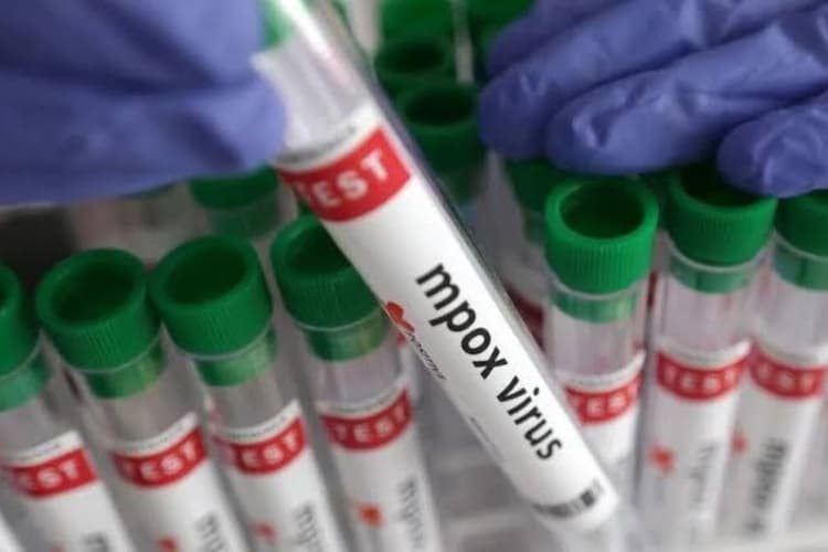 Monkeypox: देश में पांव पसार रहा मंकीपॉक्स, दिल्ली के बाद अब केरल में भी मिला केस