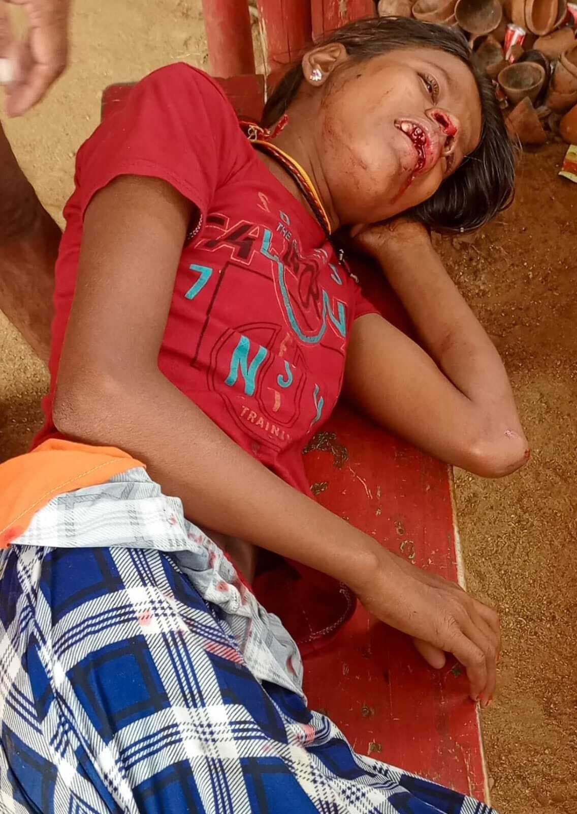 अज्ञात वाहन के धक्के से नेपाल की कांवरिया घायल