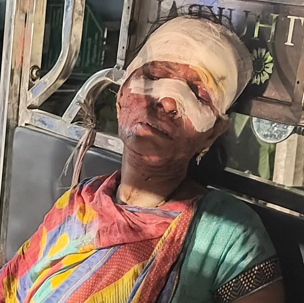 जलावन चोरी करने के आरोप में दंपती व बहू से मारपीट