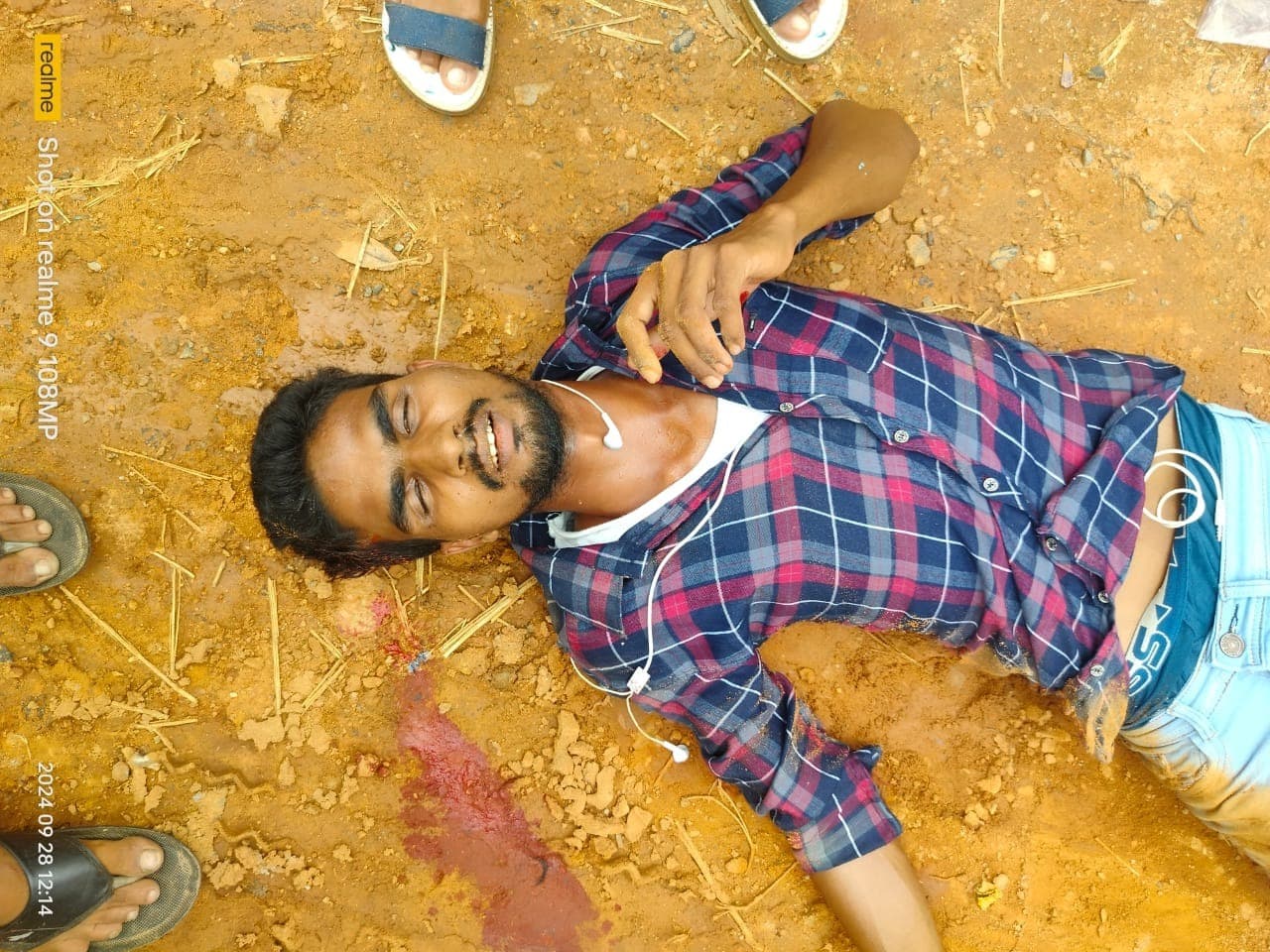 बाइक सवार सड़क पर गिर कर घायल