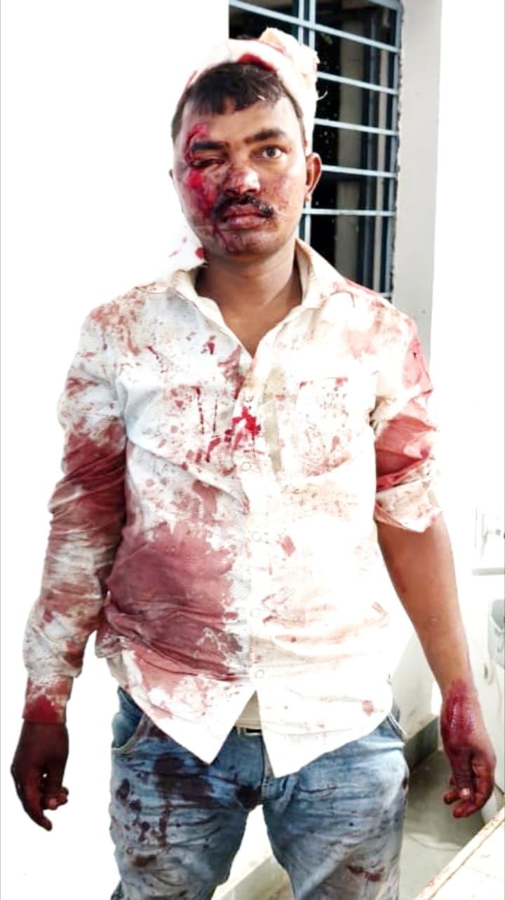 बाजार से लौटते समय दुर्घटना में महिला की मौत, पति घायल