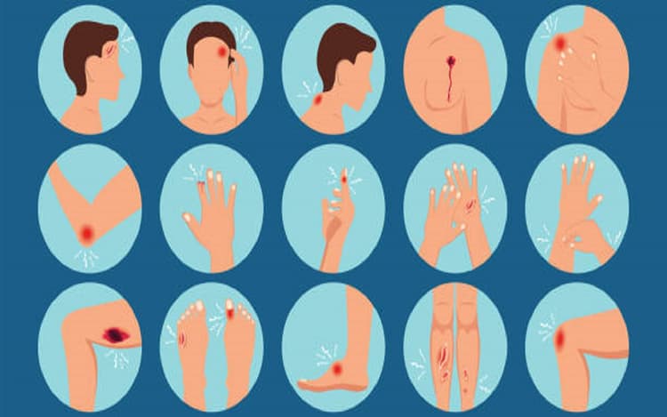 Skin Care Tips: छोटे चोट और घावों को भरने के बहुत कारगर हैं ये देसी उपाय