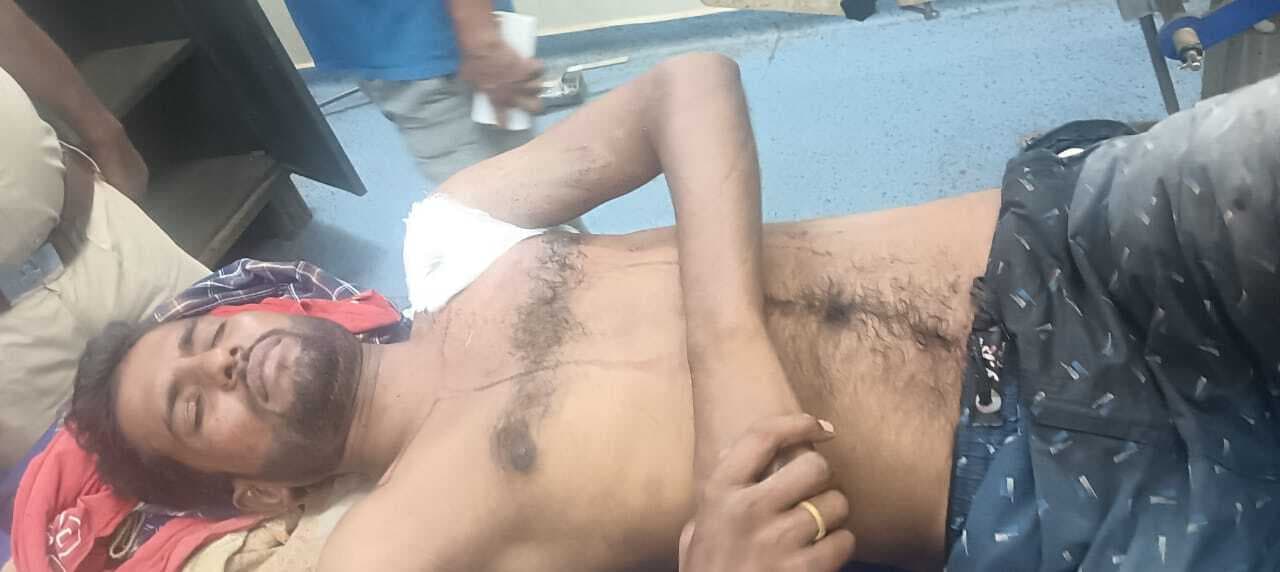 बाइक सवार बदमाशों ने युवक को मारी गोली, जख्मी