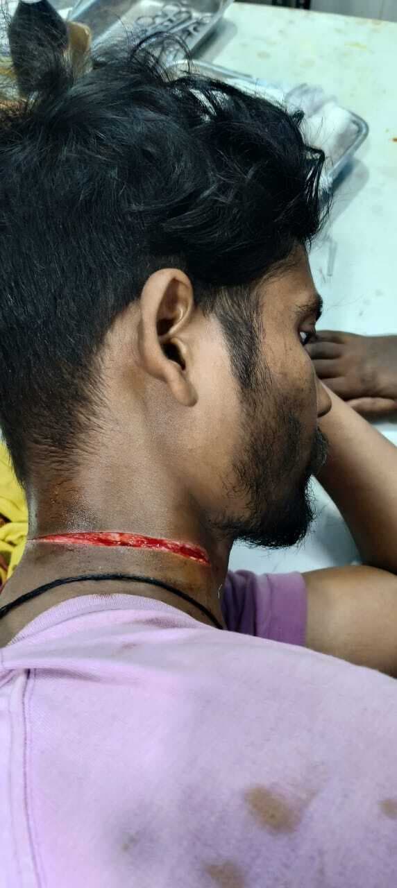 गर्दन पर धारदार हथियार से किया हमला