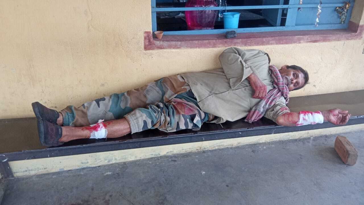 Giridih News:कोयला चोरी रोकने पर किया हमला, होमगार्ड घायल