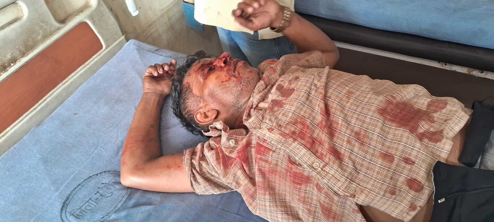 सड़क किनारे खड़ी ट्रैक्टर से टकरायी मिनी बस, चालक सहित दो घायल घायल