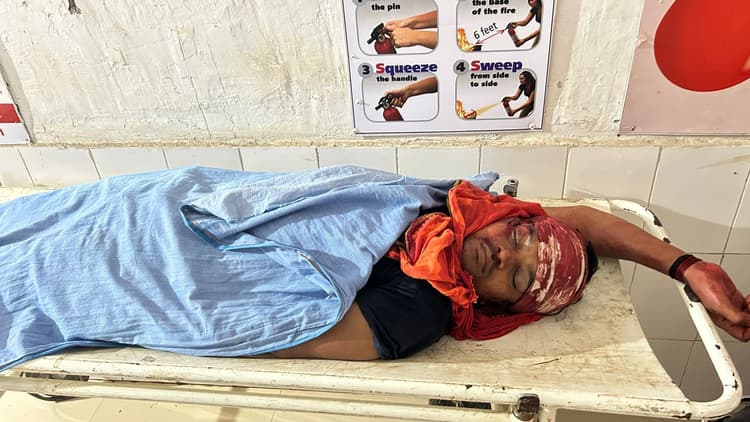 मामूली बात पर गुस्से में आकर युवक ने खुद को मारी गोली, मौत