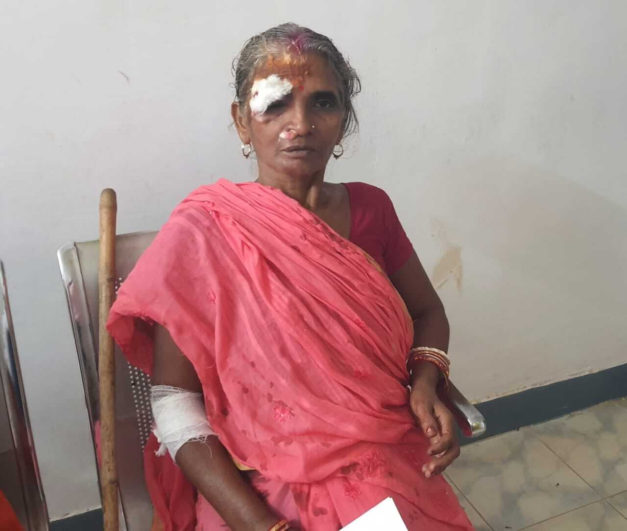 दो बाइक की टक्कर में महिला समेत तीन लोग हुए घायल