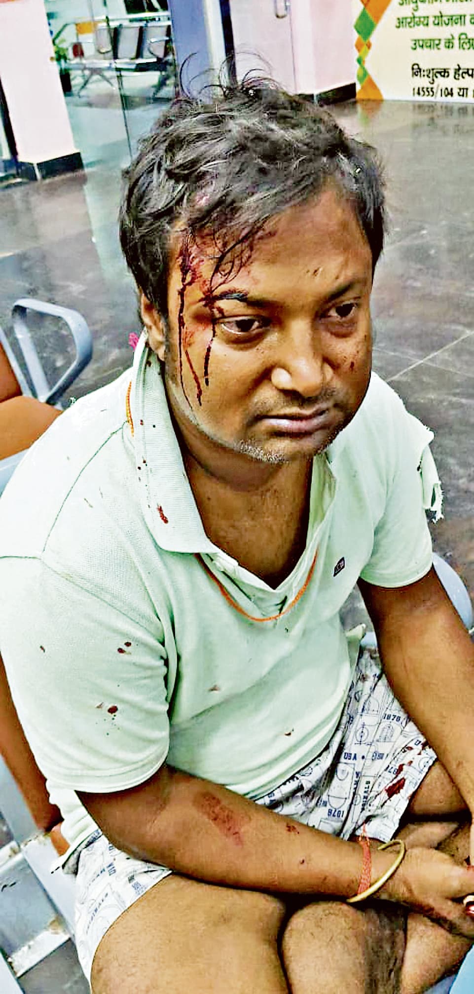 रंगदारी में दवा नहीं दी, तो दुकानदार समेत तीन के साथ मारपीट, सिर फोड़ा, तोड़फोड़ की