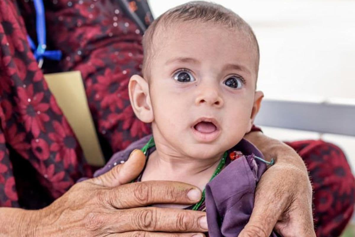 Bhagalpur: जिले की 40 पंचायतों को कुपोषण व फाइलेरिया मुक्त करने की तैयारी