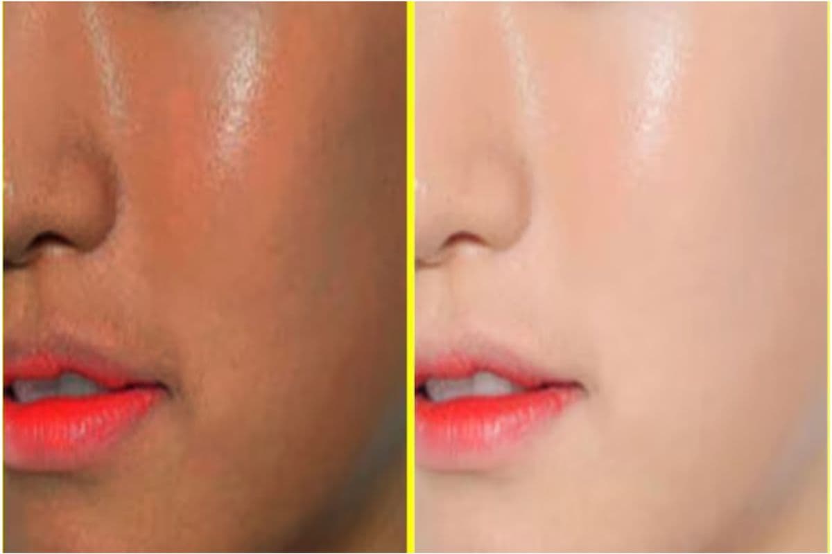 Winter Tips: रात को सोने से पहले अजमायें ये नुस्खा, सुबह खिल उठेगा आपका चेहरा