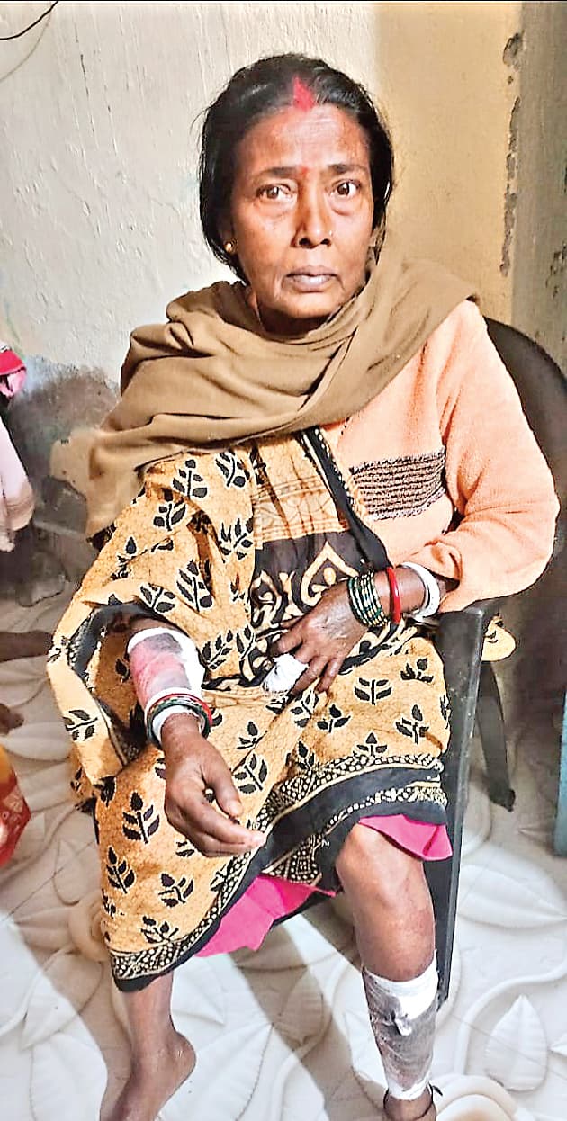 DHANBAD NEWS : सियार के हमले से आधा दर्जन घायल, महिला ने दिखायी हिम्मत, पकड़कर मचाया शोर, ग्रामीणों ने मार डाला